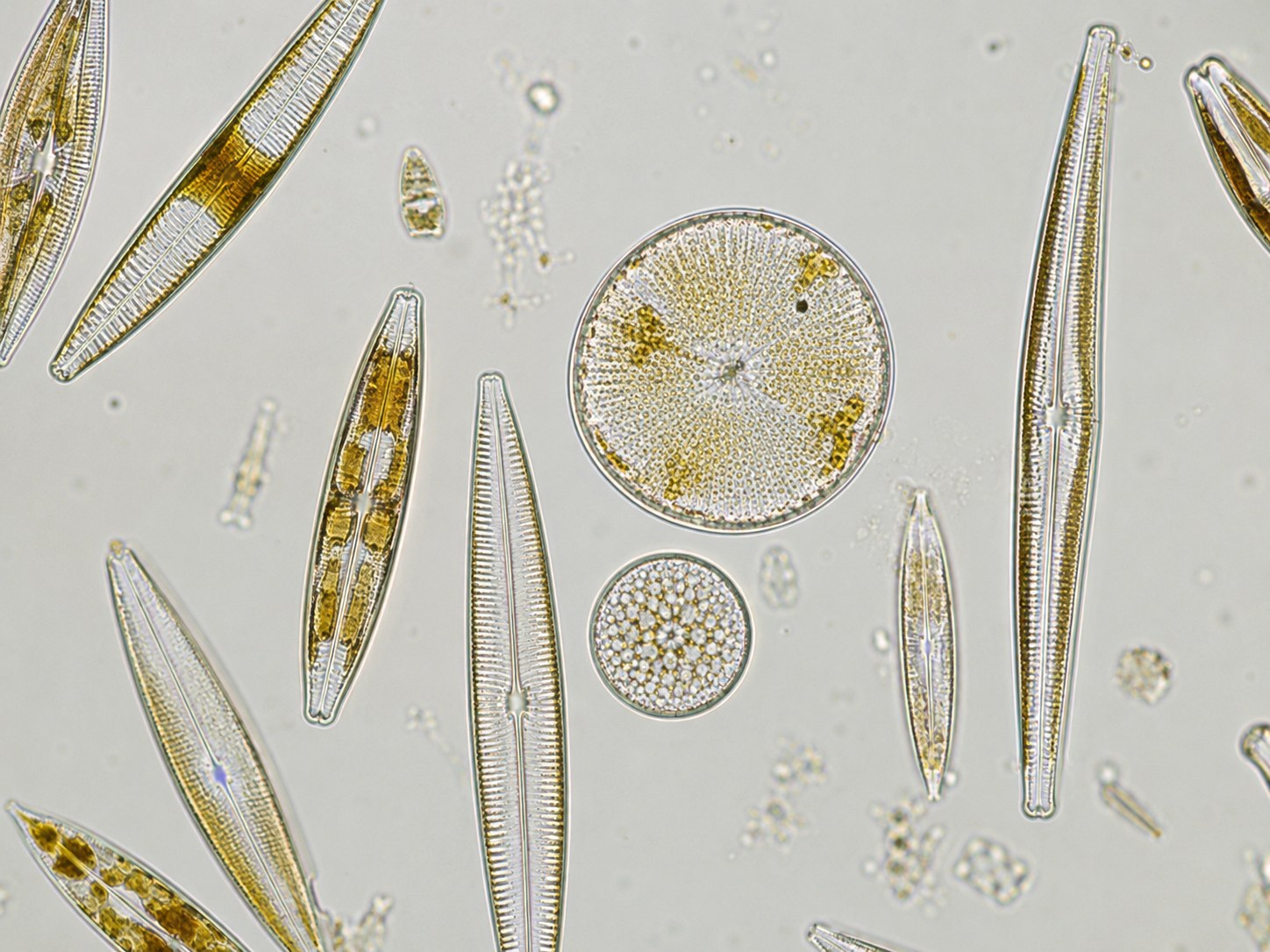 Mixed diatom frustules under light microscopy: elongated pennate forms and two circular centric forms, with golden-brown chloroplasts visible inside the silica walls.